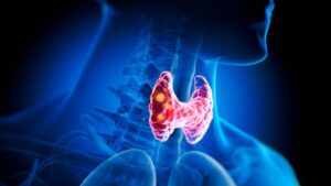 A 4 Credit 4 quadrant MOOC on Endocrinology for Beginners